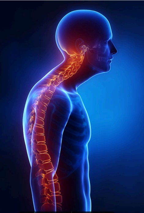 Pain Areas Cervical Spondylosis