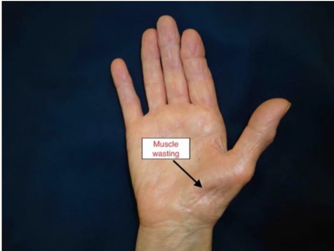 Wrist Anatomy