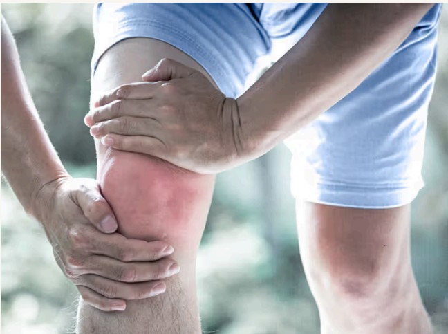 O.A. Knee with Gout Image 1