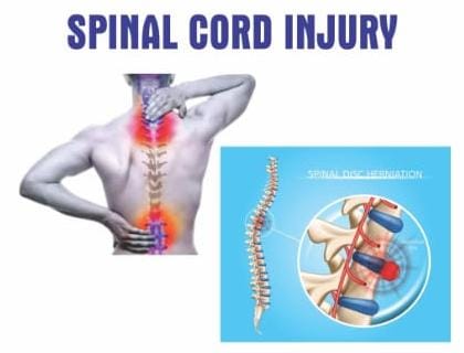 Spinal Cord Injury Kit